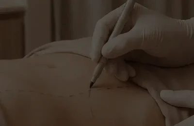 cirurgias-estéticas
